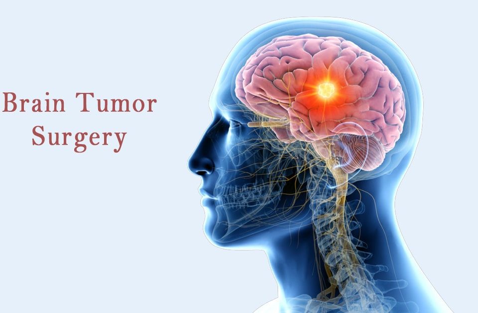 Brain tumor surgery