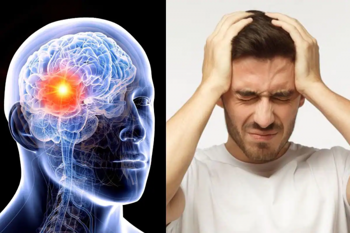 Brain Tumor - Types, Symptoms, and Causes