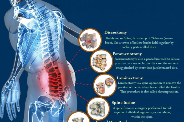 Spine Surgery - Types of Spine Surgery